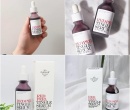 Serum tái tạo Red Peel Tingle Serum So natural – Hàn quốc